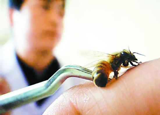 致命毒素带来的医学奇迹：无药可医时，她被一群蜜蜂蜇活了
