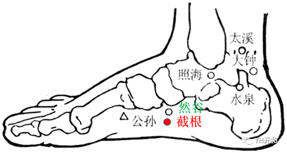 截癌穴（截根）—经外奇穴