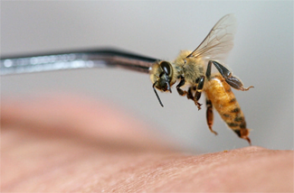 蜂毒过敏反应的预防与抢救对策