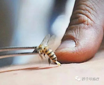 关于蜂毒